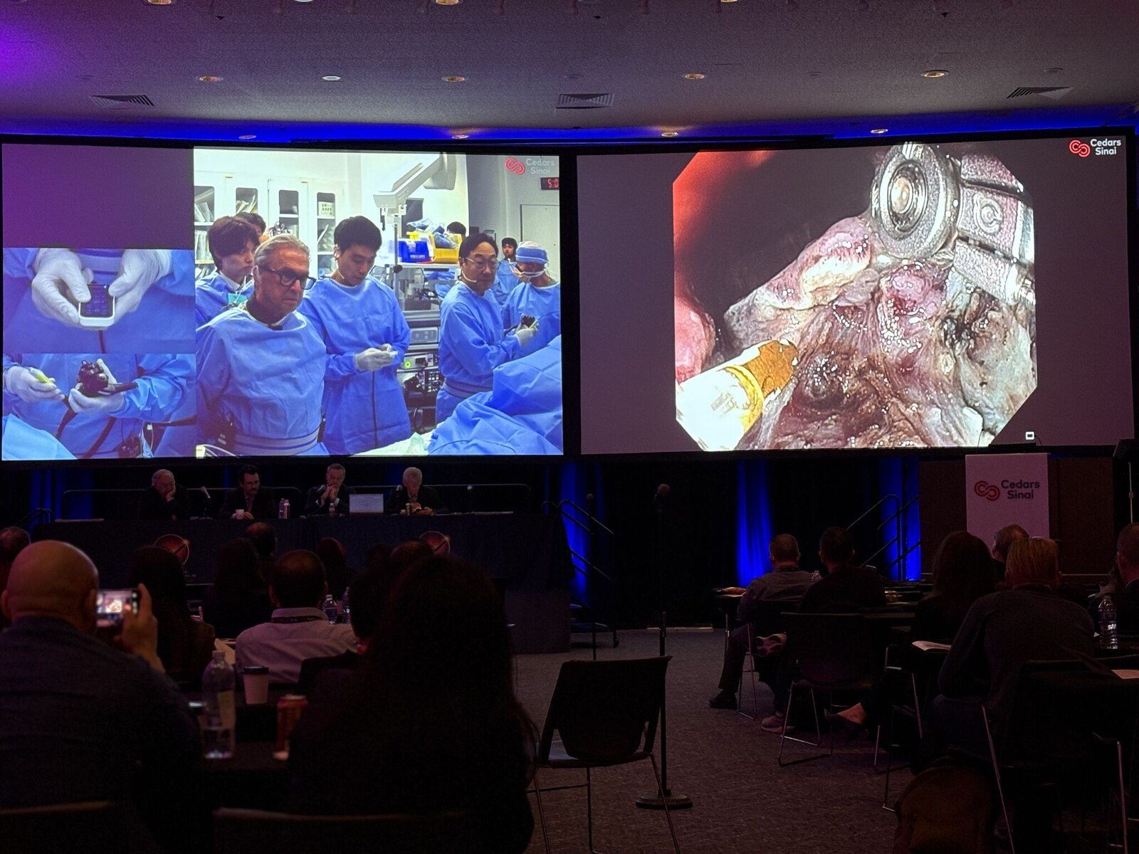 EndoRobotics at Cedars-Sinai's Future of Endoscopy Summit 2026
